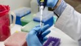 Coronavirus, test per cinque vaccini italiani
