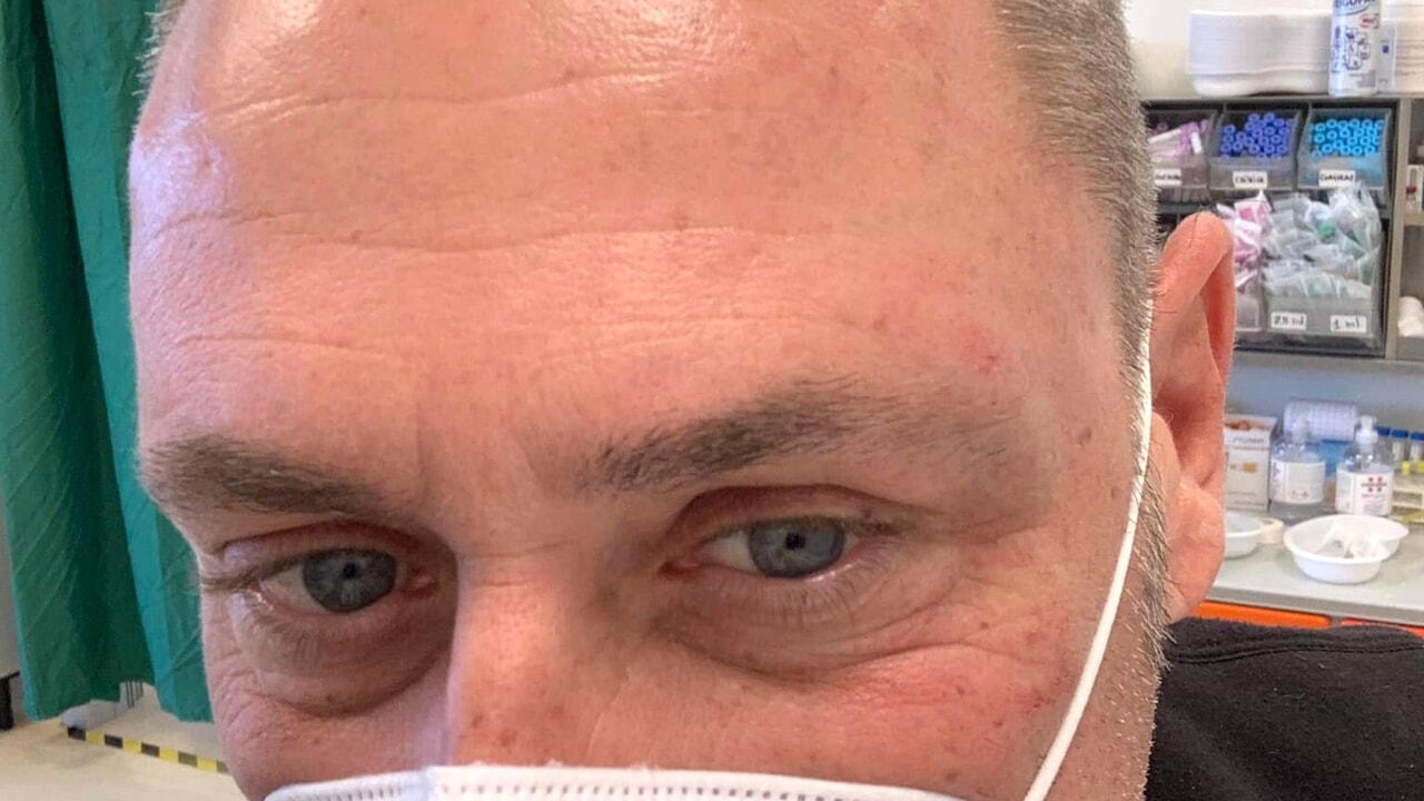 Nicola Caprera, il conduttore radiofonico pestato in strada: “Mi sono sentito come Willy”