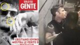 Fedez e il video della rissa con Iovino: ecco cosa è successo