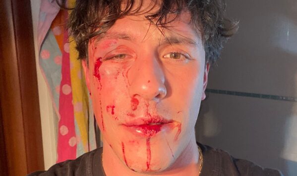 aggressione via Tiburtina Roma - Michael