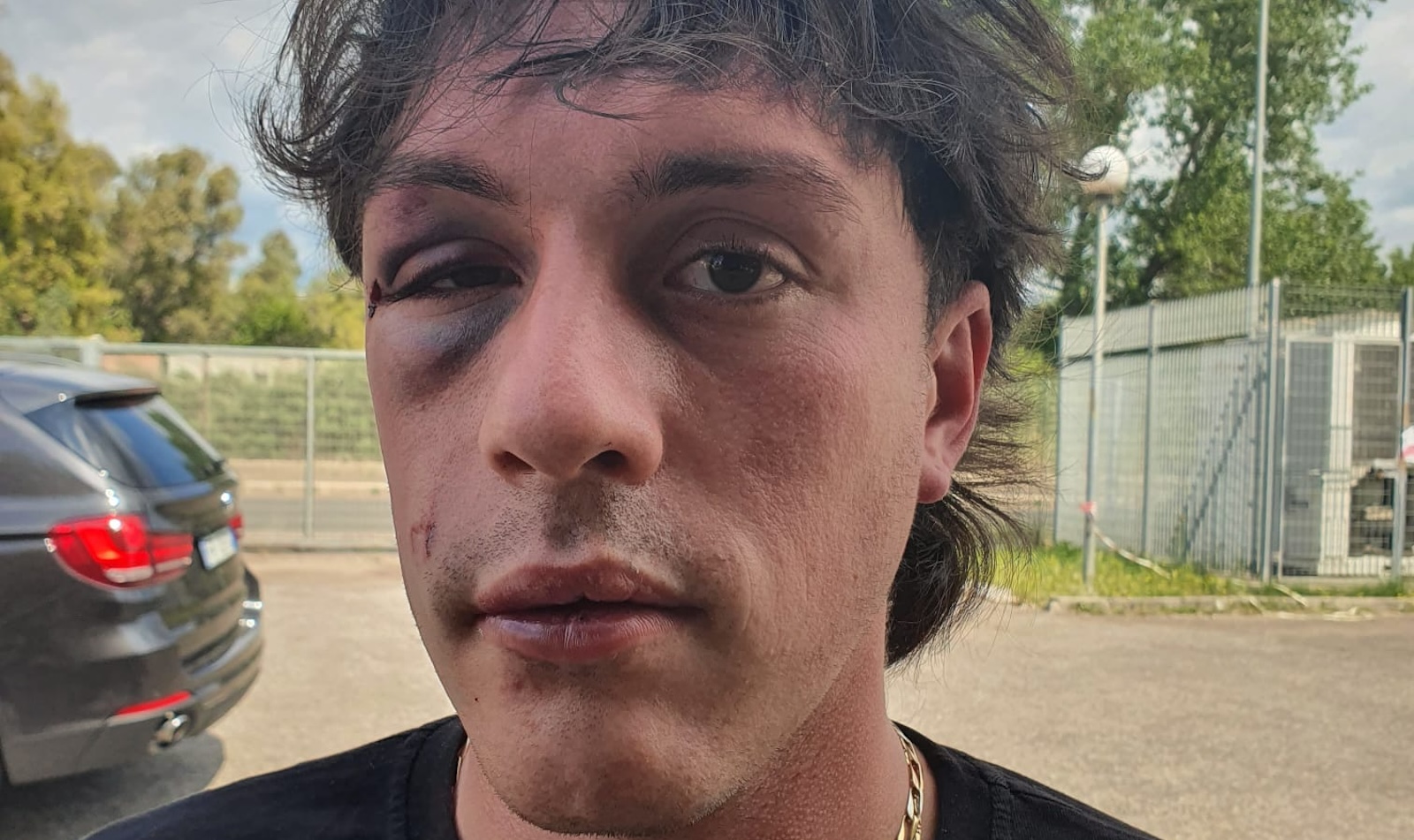 aggressione via Tiburtina Roma - Michael