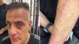 Aggredito alla stazione di Napoli lo youtuber romano Cicalone: “Colpito con un bastone, ho reagito con lo spray”