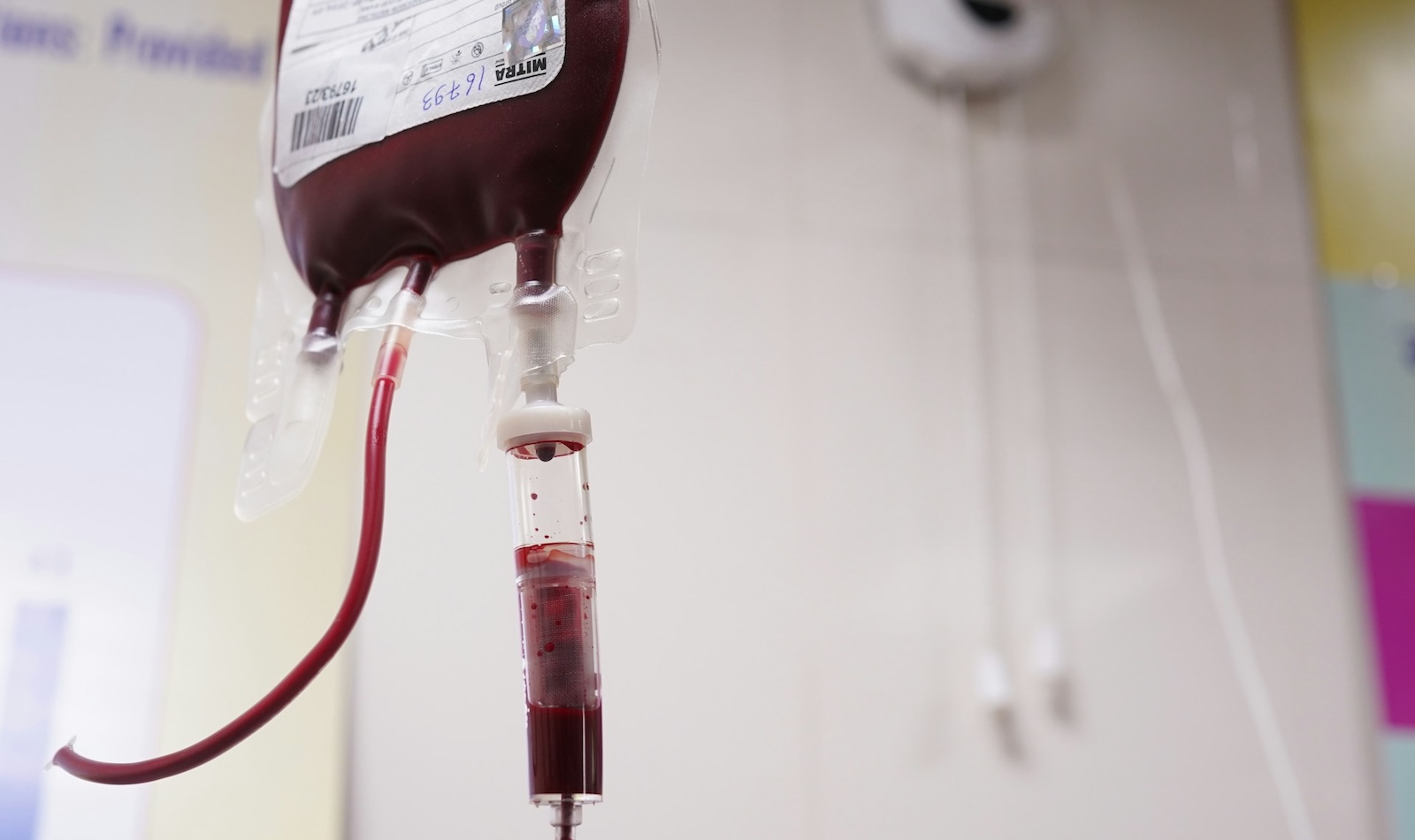 Trasfusione di sangue