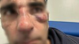Chiede il biglietto e viene aggredito: calci e pugni in faccia al controllore Daniele Stefanucci, consigliere di Fratelli d’Italia