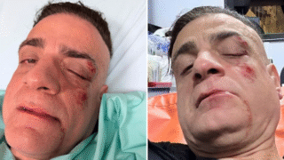 Roma, Simone Cicalone aggredito e pestato alla metro Ottaviano: dieci contro uno, “potevano uccidermi”