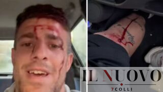 Gambizzato il tiktoker romano Damiano Sartori, lui ride e posta il video: “Mi hai lisciato”