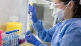 Hantavirus, infezione grave ma non pandemia: il rischio per la popolazione resta molto basso