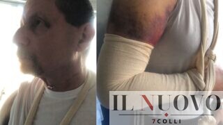 Roma, urta uno zaino in metro e viene massacrato di botte: “Ti uccido”, 58enne in ospedale, aggressore libero